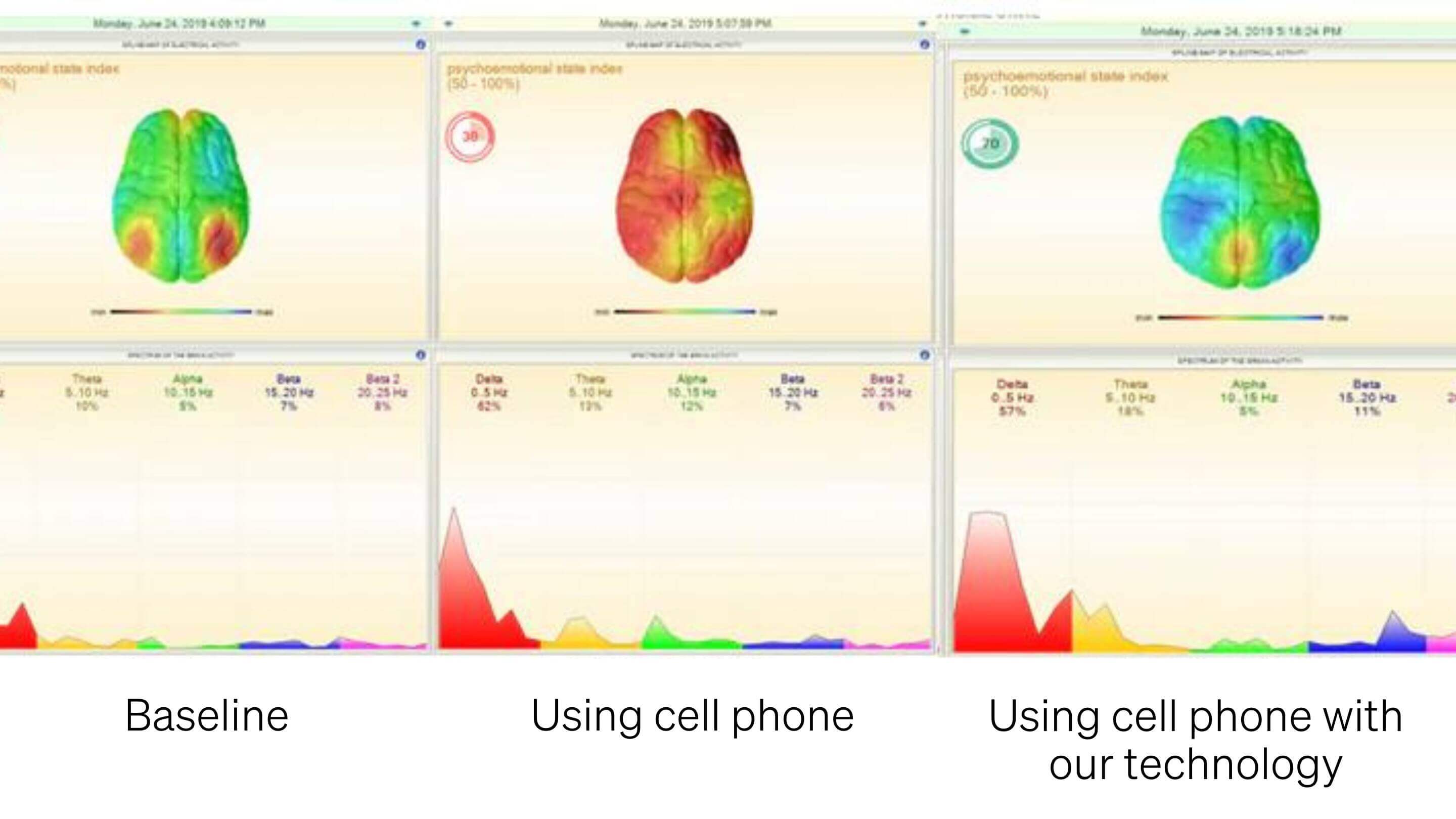 EMF protection study HRV test with cell phone